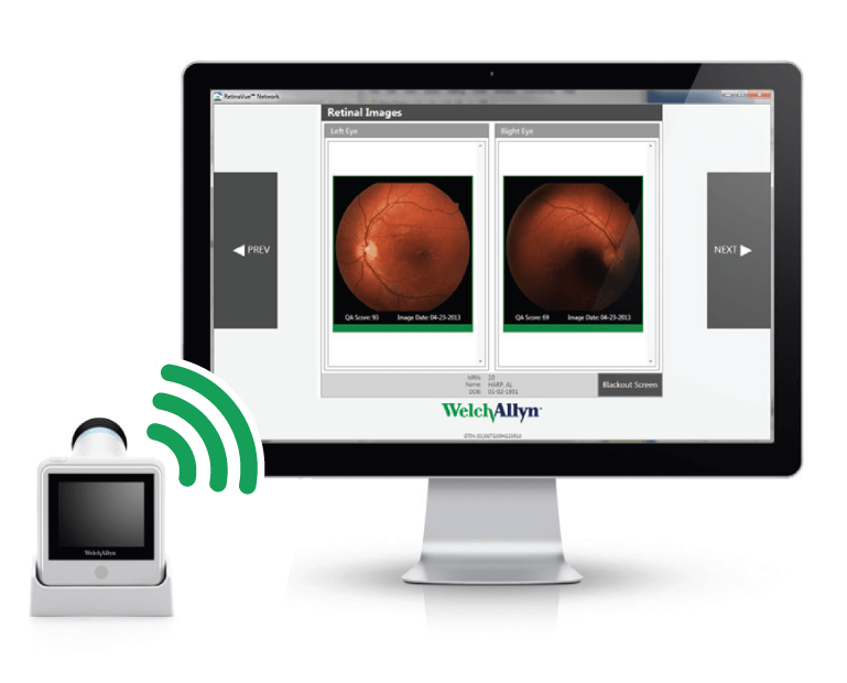 RetinaVue Network